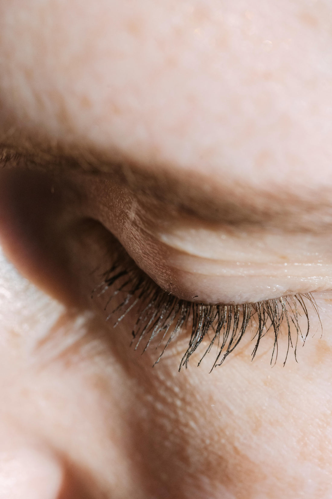 Shielding Your Skin: Repair & Protect Your Skin Barrier in the UAE